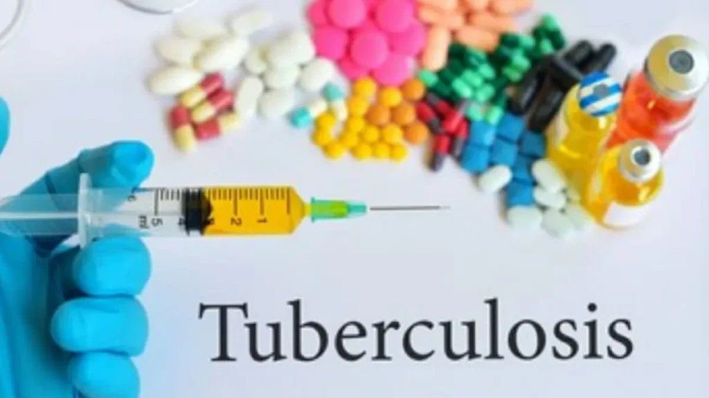 TB | காச நோய்க்கு புதிய சிகிச்சை கண்டுபிடிப்பு.!! இம்மியூனிட்டி தெரபியின் சிறப்பம்சங்கள் என்ன.? நிபுணர்கள் விளக்கம்.!!