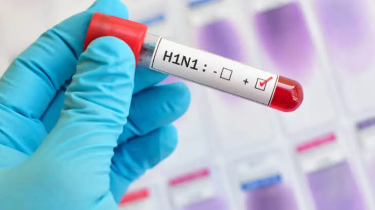 H1N1 வைரஸ் காய்ச்சல் பாதிப்பு… 4 வயது சிறுவன் உயிரிழப்பு…! இது தான் முக்கிய அறிகுறிகள்…!