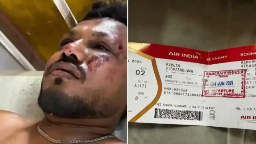 “இன்னும் என்னால் இதை நம்ப முடியவில்லை..” அகமதாபாத் விமான விபத்தில் உயிர் பிழைத்த நபர் உருக்கம்..