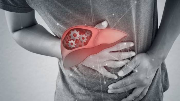 Fatty Liver 2025 05 5e3332a6381853a47963d69e194ef507 16x9 1