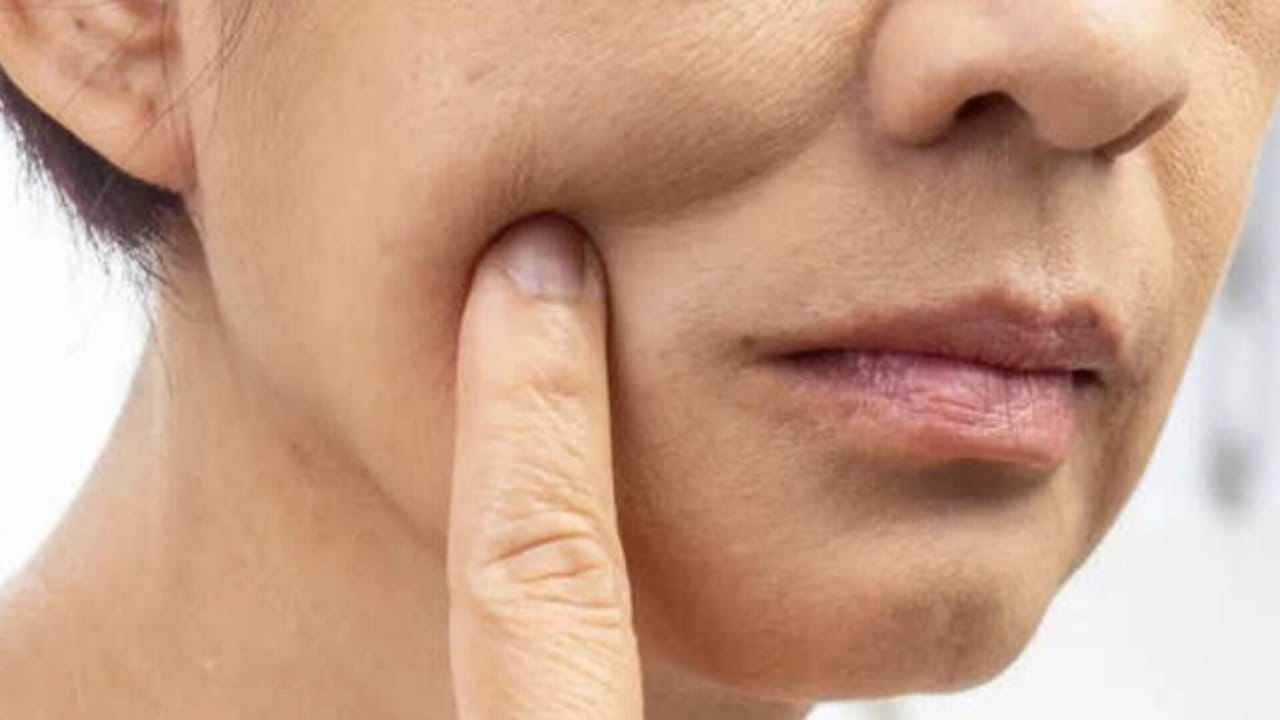 Mouth cancer 11zon Mouth cancer 11zon