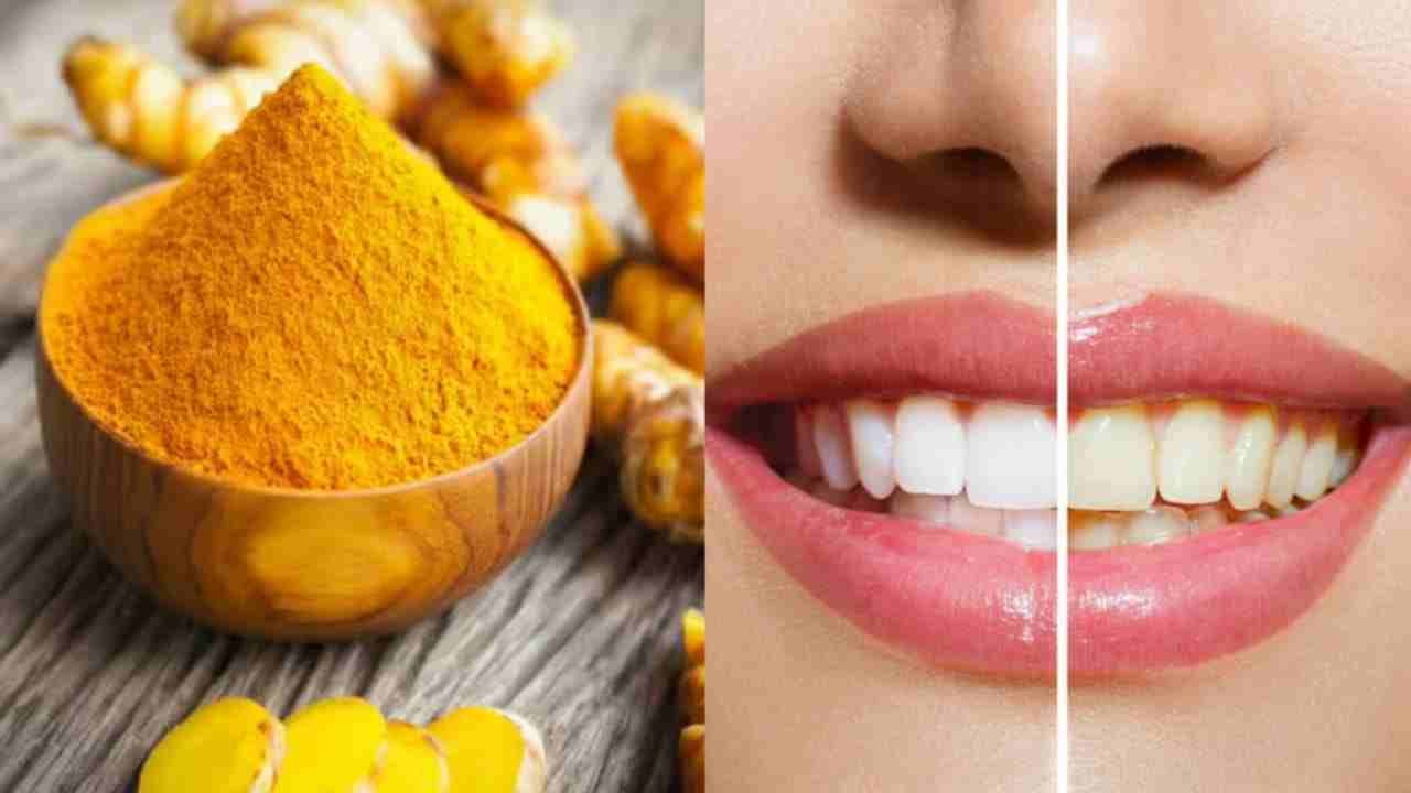 Yellow stains teeth 11zon