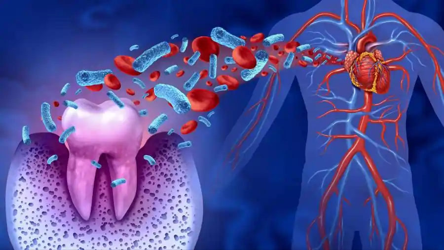 bacteria heart attack bacteria heart attack