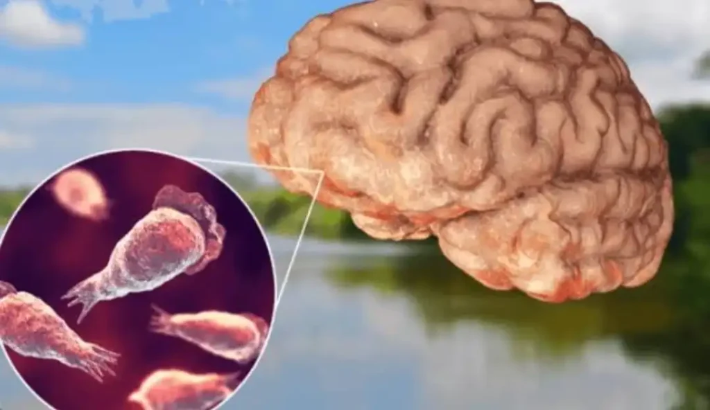 brain2025 மூளையைத் தின்னும் அமீபாவால் மேலும் ஒரு பெண் மரணம்.. அச்சத்தில் மக்கள்!