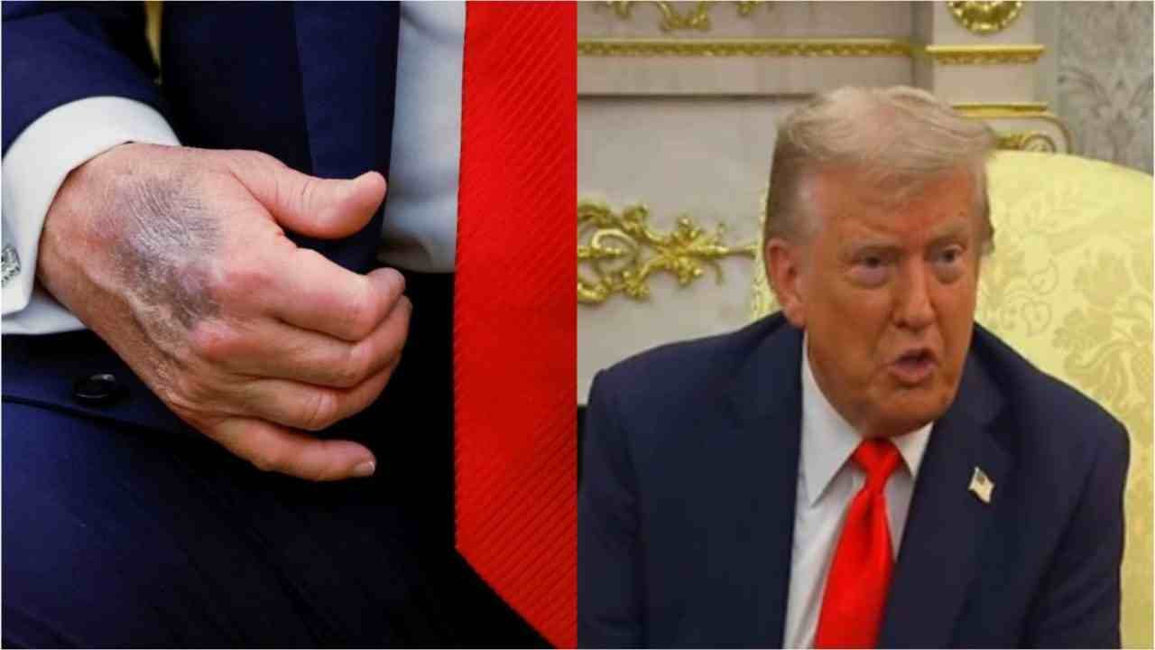 health concerns trump 11zon