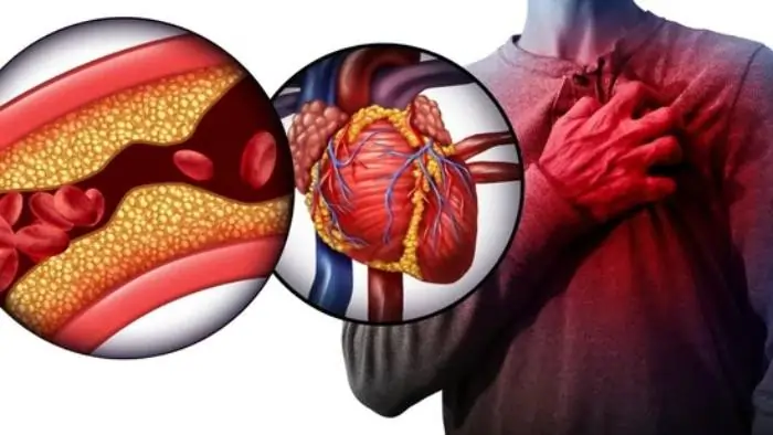 heart cholestrol sugar damage heart cholestrol sugar damage