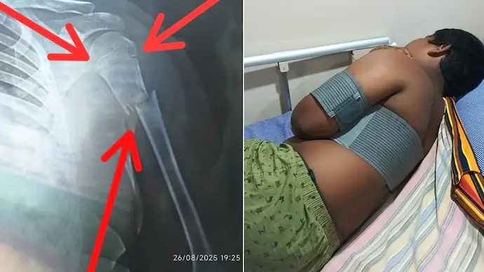 teacher breaks students arm 281303678 16x9 0 1 teacher breaks students arm 281303678 16x9 0 1