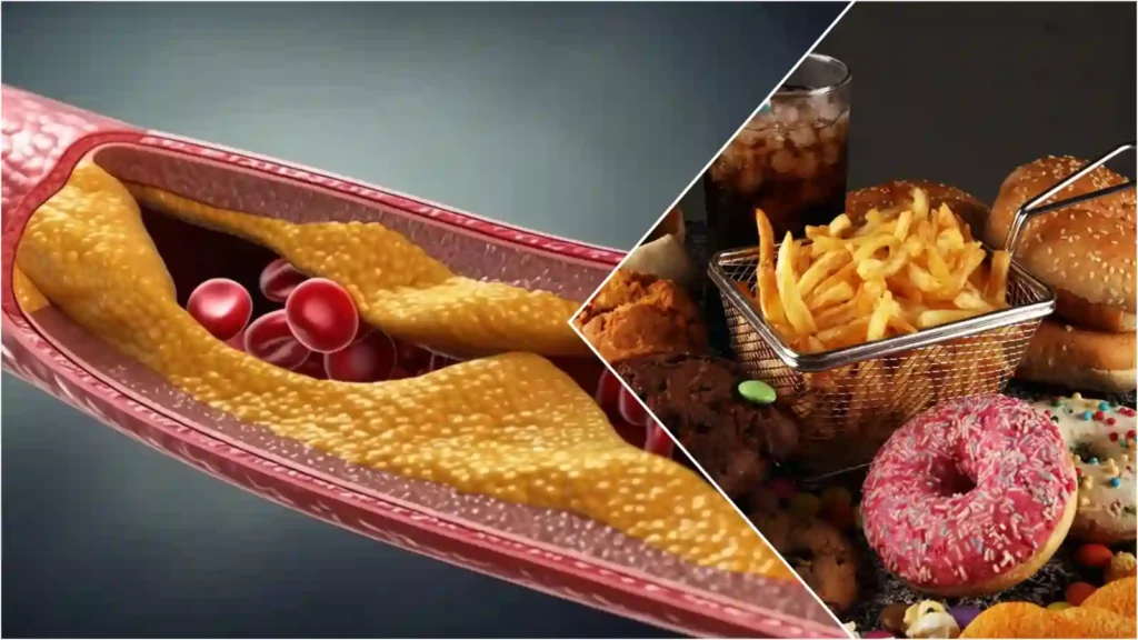 Cholesterol 2025 Cholesterol 2025