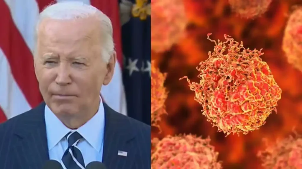 Joe Biden skin cancer ஜோ பைடனுக்கு புதிய தோல் புற்றுநோய்!. புண்களை அகற்ற அறுவை சிகிச்சை!. செய்தித் தொடர்பாளர் ஷாக் தகவல்!.