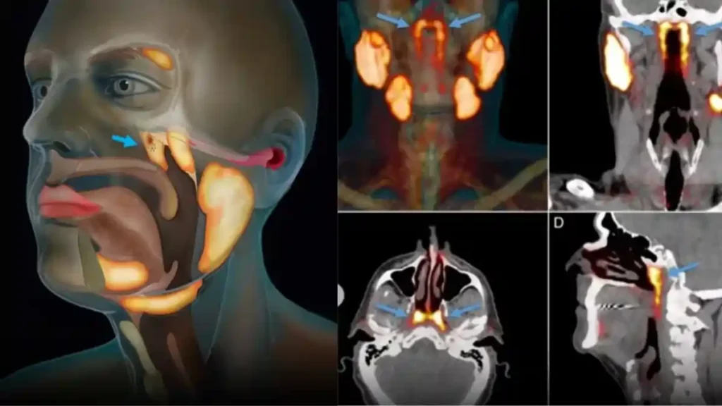 Secret Organ 1 மனித உடலில் புதிய சுரப்பி கண்டுபிடிப்பு.. புற்றுநோய் சிகிச்சையில்  புரட்சி ஏற்படும்..!! விஞ்ஞானிகள் கூறுவது என்ன..?