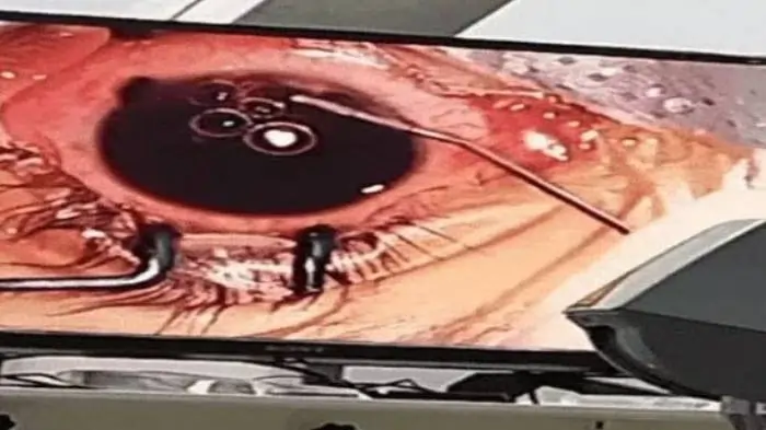 baby eye charger baby eye charger