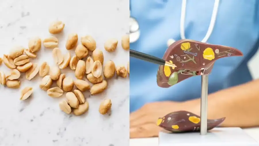 peanut peanut