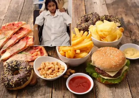 ஜங்க் ஃபுட்ஸ் அதிகம் சாப்பிட்ட 16 வயது சிறுமி குடல் அழுகி உயிரிழப்பு.. பெற்றோர்களே மிக மிக கவனம்!