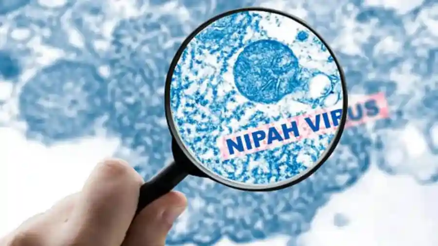nipah virus nipah virus