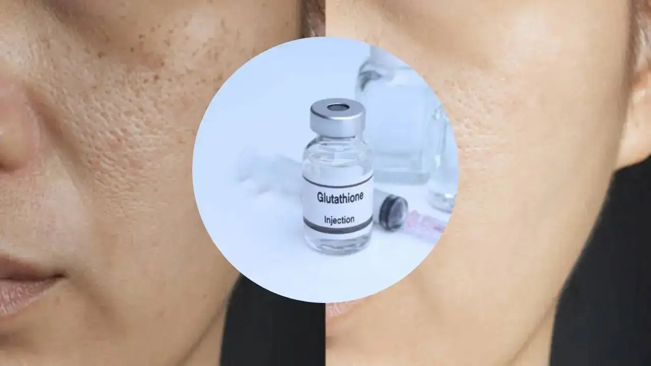 beauty injections