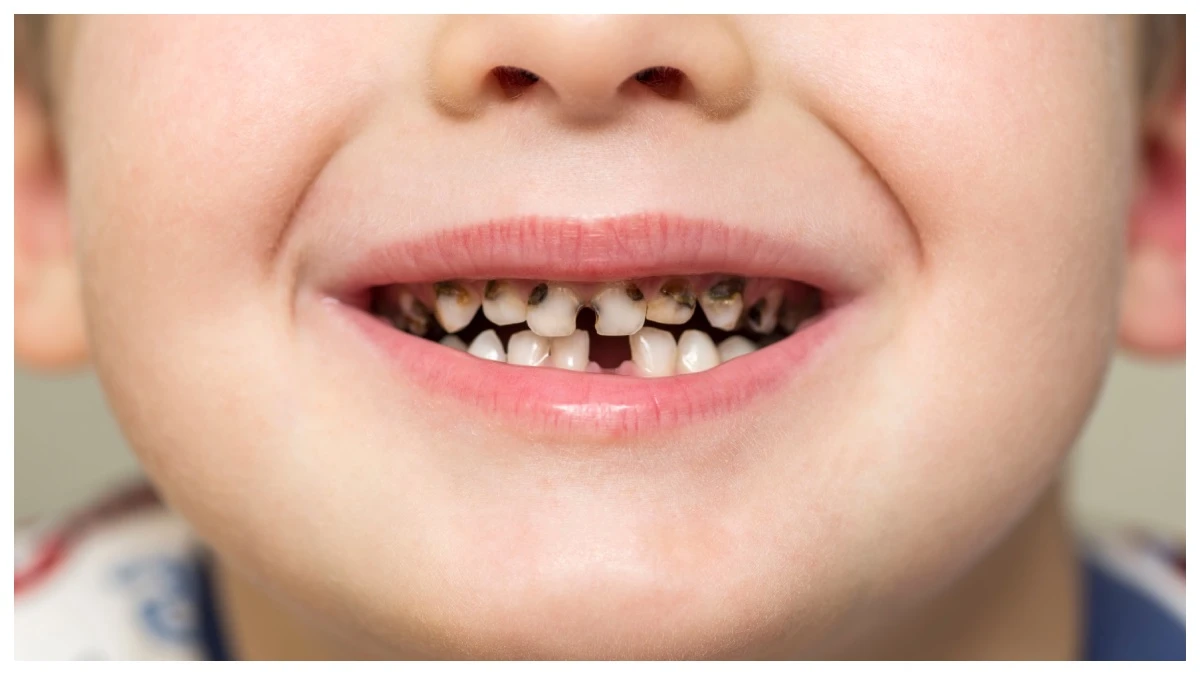 Teeth 2026 Teeth 2026